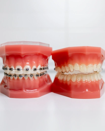 Orthodontic preparation