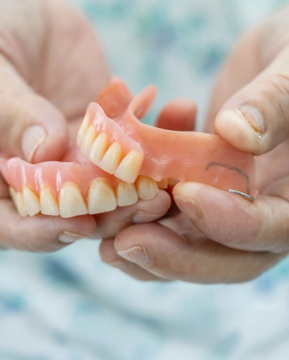 Partial Dentures